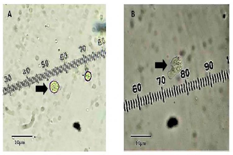 Micrographs of isolated Naegleria sp. (A) cyst and (B) trophozoite. Photos courtesy of G. Milanez, Far Eastern Univeristy Manila