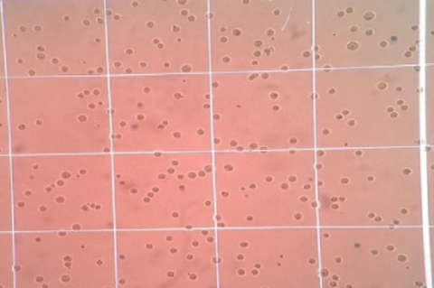 Effect of the extract on mouse DLA cell lines.